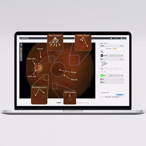 Piattaforma AI per oftalmologia - UMI DR - ULMA Medical Technologies - diagnostica / di rilevamento