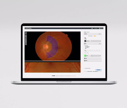 Modulo software di misura - UMI AVR - ULMA Medical Technologies - per oftalmologia / di retina / di arteria