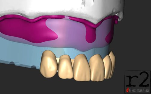 Software di progettazione - BiteReg  - Dentona AG - d’importazione / di stampa 3D / di modelizzazione