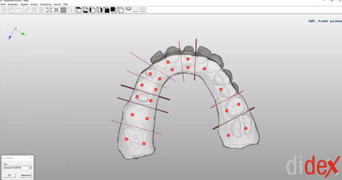 Software per laboratorio dentale - didex  - Dentona AG - di acquisizione / di stampa 3D / di modelizzazione