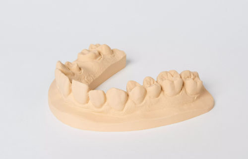 Materiale odontoiatrico in pietra - esthetic-base® evolution - Dentona AG - per laboratorio odontotecnico / di modelizzazione