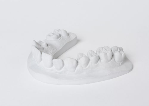 Materiale odontoiatrico in pietra - esthetic-rock® 285 - Dentona AG - di modelizzazione