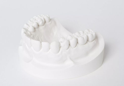 Materiale odontoiatrico in gesso - dento-stone® 220  - Dentona AG - da colata / per fabbricazione di dentiere / di modelizzazione