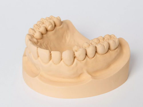 Materiale odontoiatrico in pietra - rapid - Dentona AG - per portaimpronte / per fabbricazione di dentiere / di modelizzazione