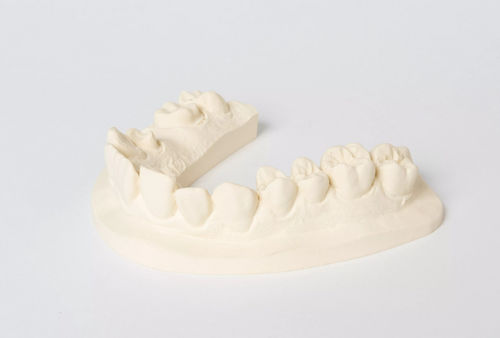 Materiale odontoiatrico in pietra - No. 1 - Dentona AG - per laboratorio odontotecnico / di modelizzazione