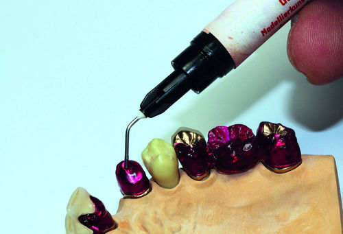 Materiale odontoiatrico in resina - 54500 - Dentona AG - per ricostruzione dentale / per sistemi implantari / per fabbricazione di dentiere