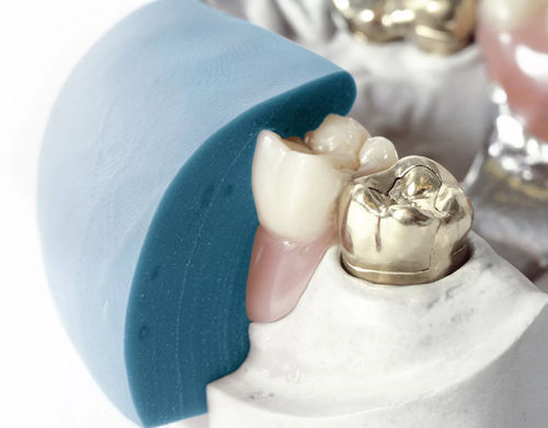 Materiale odontoiatrico in silicone - gum 85  - Dentona AG - di modelizzazione