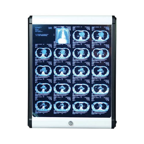 Negativoscopio 1 corpo - SSMEC-VB-100 - Samsung Medi Engineering