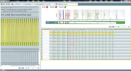 Software medico - SwIm03 - TestLine Clinical Diagnostics - da laboratorio / per immunoblot / di analisi