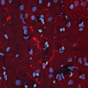 Reagente per beta-endorfina - RA21004 - Neuromics - anticorpo policlonale / IgG / per ricerca scientifica