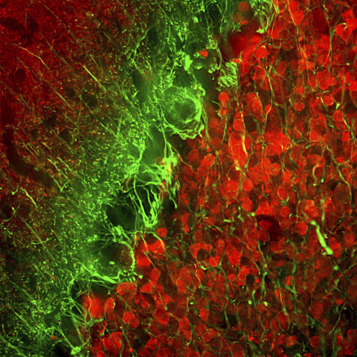 Reagente per alfa-internexina - MO22154 - Neuromics - anticorpo monoclonale / IgG / per ricerca scientifica