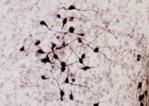 Reagente ossitocina - RA24604 - Neuromics - anticorpo / di siero / per immunoistochimica