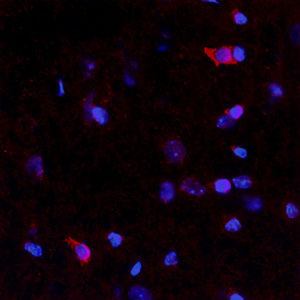 Reagente anticorpo - RA21023 - Neuromics - per ricerca scientifica / per western blot / per immunoistochimica