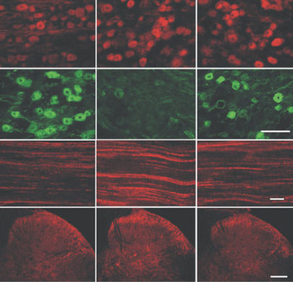 Reagente IgG - GP10110 - Neuromics - per ricerca scientifica / per immunoistochimica / liquido