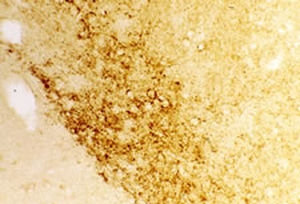 Reagente IgG - RA20072 - Neuromics - per ricerca scientifica / per immunoistochimica / liofilizzato