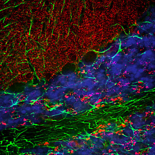 Reagente anticorpo - CH22139 - Neuromics - per western blot / per immunoistochimica / per immunofluorescenza
