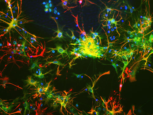 Reagente anticorpo monoclonale - MO22143 - Neuromics - per ricerca scientifica / per western blot / per immunoistochimica
