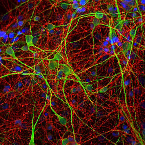Reagente anticorpo - MO22170 - Neuromics - per ricerca scientifica / per western blot / per immunoistochimica