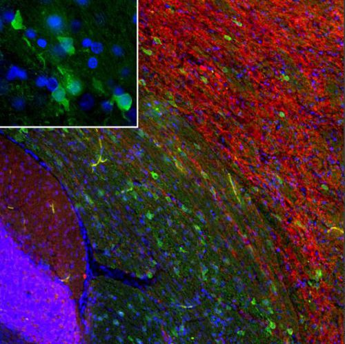 Reagente IgG - MO22196 - Neuromics - per western blot / per immunofluorescenza / per immuncitochimica