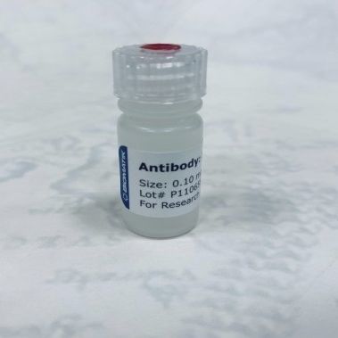 Reagente anticorpo policlonale - CAU21001 - Biomatik - da ricerca / liquido / di origine animale