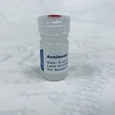 Reagente anticorpo policlonale - CAU21006 - Biomatik - da ricerca / liquido / di proteine