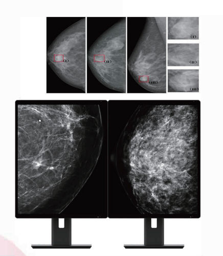 Monitor medico - MC50A - ZRT Technology - diagnostico / per mammografia / 21.3"