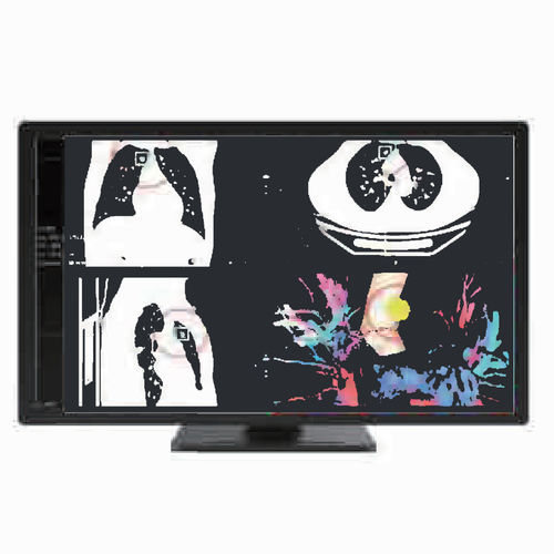 Monitor medico - MC80A - ZRT Technology - diagnostico / 3840 × 2160 / 31.5"