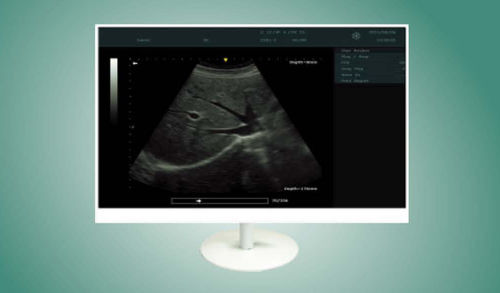 Monitor medico - MS2210 - ZRT Technology - per endoscopia / 1920 x 1080 / 21,5"