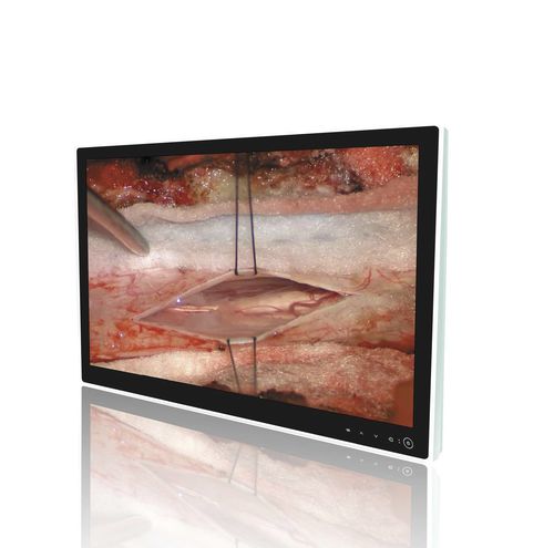 Monitor medico - MS8270P - ZRT Technology - per sala operatoria / per endoscopia / 3840 × 2160