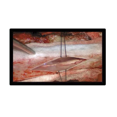 Monitor per sala operatoria - MS2270P - ZRT Technology - per endoscopia / 1920 x 1080 / 27"