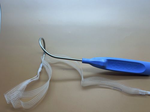 Fascetta per ricostruzione per l'incontinenza urinaria - I-STOP TOMS - APIS Technologies - via transotturatoria / per uomo