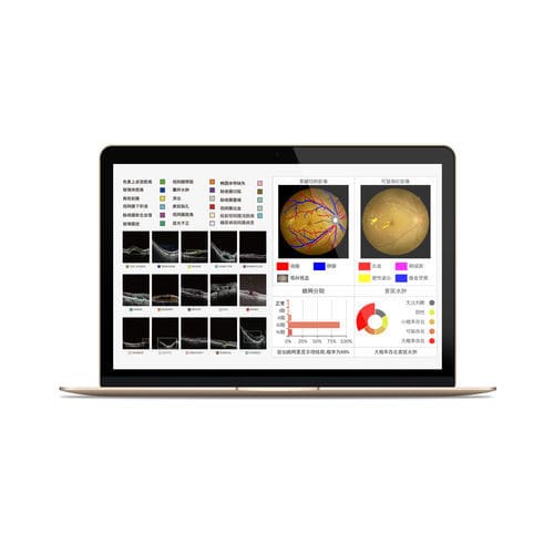 Software di analisi - MIAS - Big Vision Medical - diagnostico / di rilevamento / medico