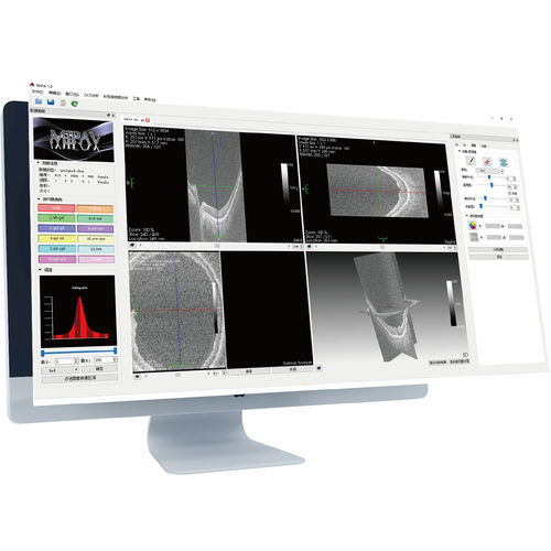 Software per oftalmologia - MIPA  - Big Vision Medical - di aiuto