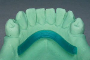 Materiale odontoiatrico cera - WaxStar - scheftner dental - per ricostruzione dentale