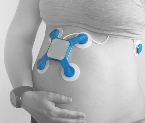Piattaforma AI per maternità - Baymatob - di monitoraggio / diagnostica