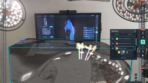 Piattaforma AI per diagnostica per immagini - SurgicalAR® - MEDIVIS - di pianificazione preoperatoria / didattica / di stampa 3D