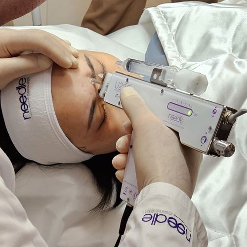 unità di mesoterapia - Needle Concept