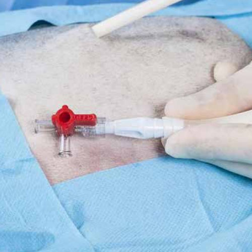 Valvola per il settore medico - 00120001 - QUIROSA, S.A - blu / rossa