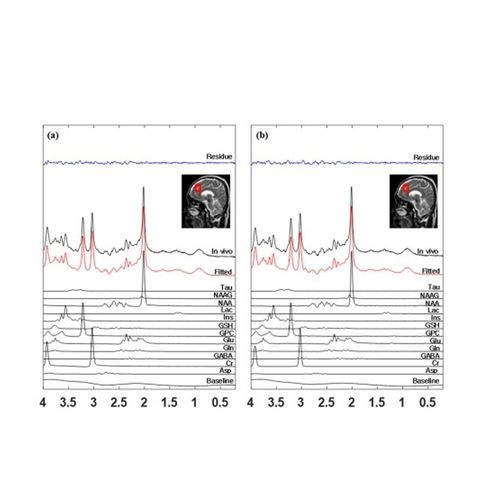 Software di analisi - LC - MTech Lab - MRI