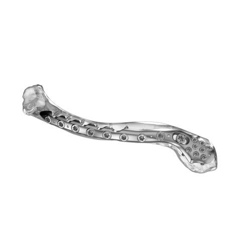 Placca di compressione per clavicola - Aplus Biotechnology - bloccata / in titanio