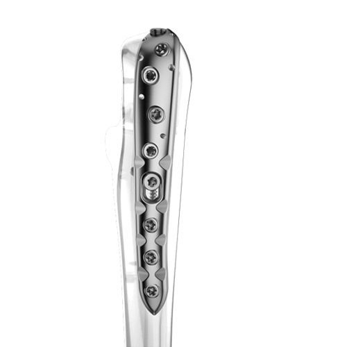 Placca di compressione per ulna - 0316-0100:0101 series - Aplus Biotechnology - per olecrano / prossimale / bloccata