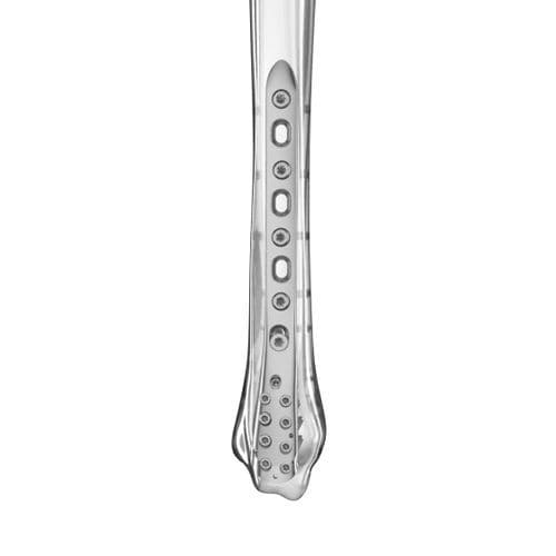 Placca di compressione per tibia - Aplus Biotechnology - distale / mediale / bloccata