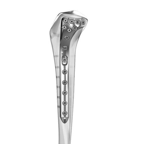 Placca di compressione per tibia - Aplus Biotechnology - prossimale / laterale / bloccata
