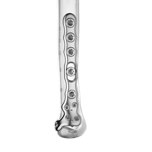 Placca di compressione per ulna - 0315-0000:0001 series - Aplus Biotechnology - distale / bloccata / in titanio