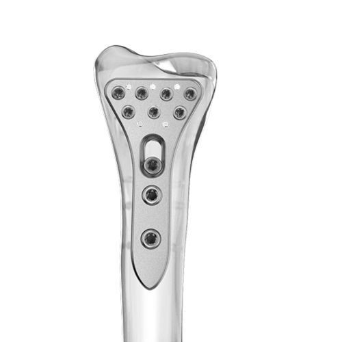 Placca di compressione per radio - 0401 series - Aplus Biotechnology - distale / bloccata / in titanio