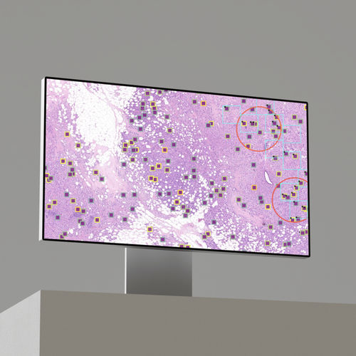 Piattaforma AI per screening del tumore al seno - CleoBreast®  - Primaa - medica / diagnostica / di analisi delle immagini