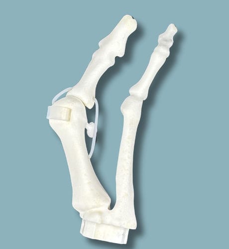 Modello anatomico per metatarso - 01-09-01 - ADDIDREAM - per chirurgia ortopedica / didattico / in plastica