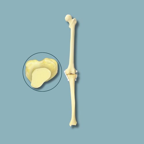 Modello anatomico per ginocchio - 04-01-03 - ADDIDREAM - per chirurgia / didattico / in espanso