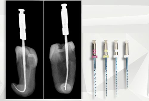 Lima odontoiatrica rotativa - croot0003 - C-Root Dental Medical - per trattamenti canalari / NiTi