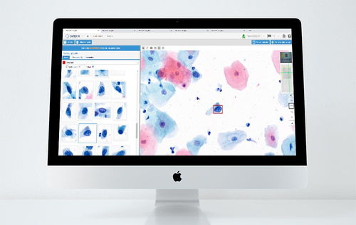 Piattaforma AI per ricerca medica - CYTOPROCESSOR® - DATEXIM - per laboratori / di screening del tumore del collo dell’utero / basata sul web
